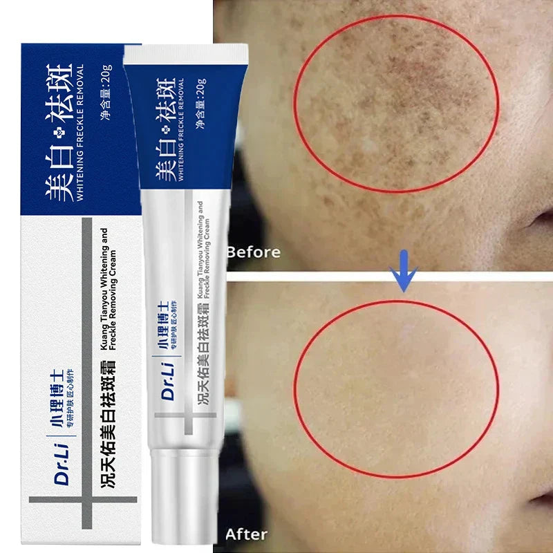 Whitening Freckles Cream - Korean Skincare